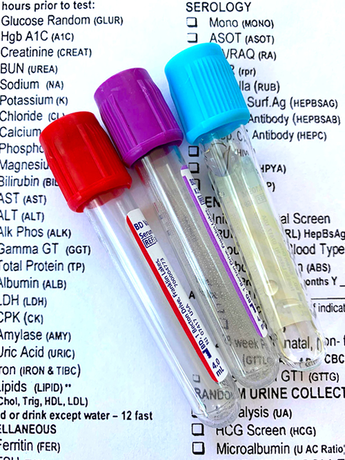 Blood sample tubes on a laboratory requisition